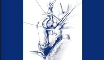 Comprehensive Surgical Management of Congenital Heart Disease