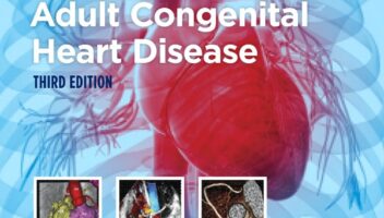 Diagnosis and Management of Adult Congenital Heart Disease