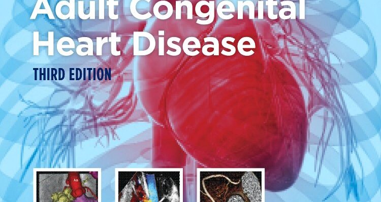 Diagnosis and Management of Adult Congenital Heart Disease